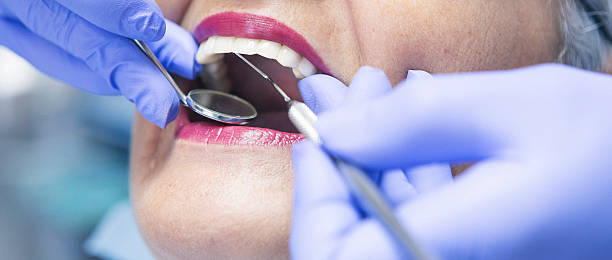 Best Emergency Treatment for Oral Infections in Memphis, MI